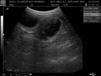 /album/spinone-beretta/cora-jpg/